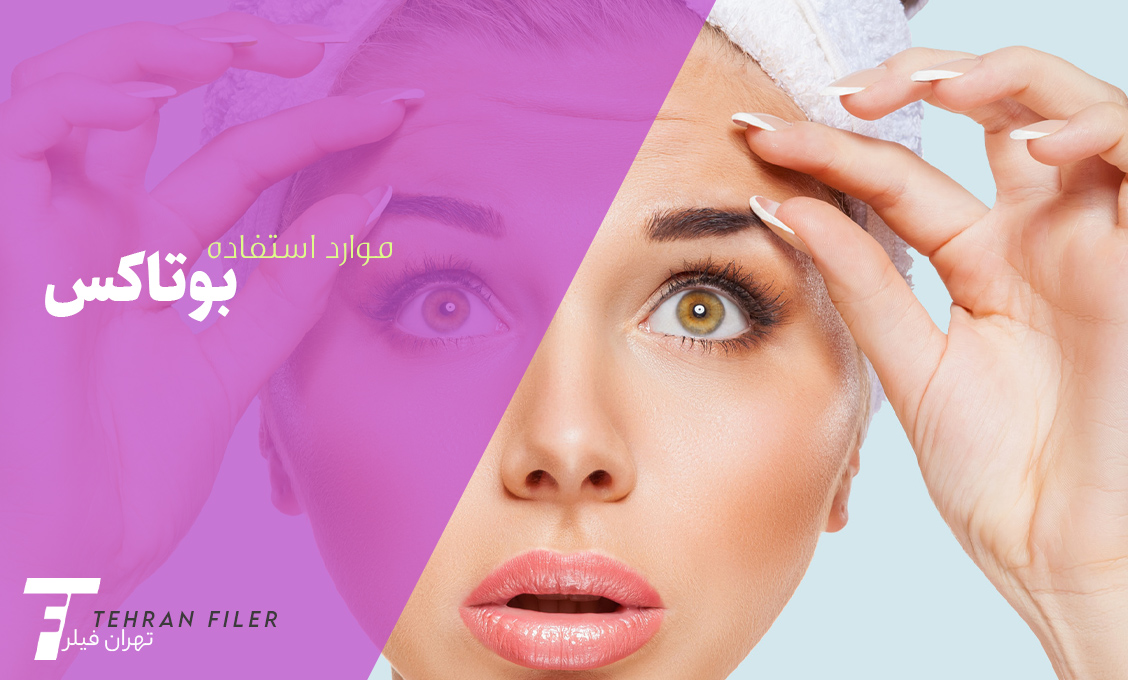 موارد استفاده بوتاکس