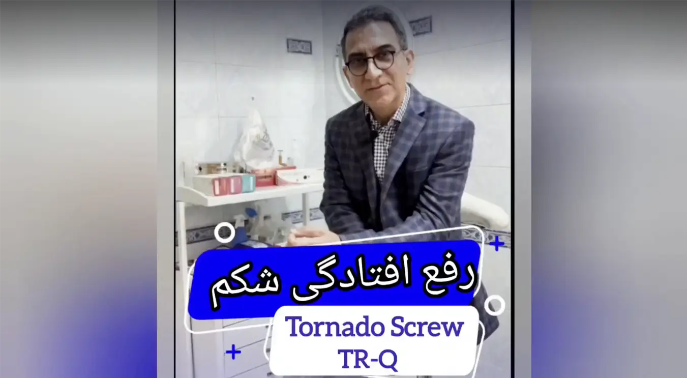 لیفت و جوان‌سازی شکم با نخ فیش‌بن و تورنادو‌اسکرو TR-Q