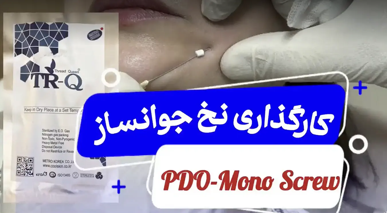 کارگذاری نخ جوانساز mono screw برند TR-Q